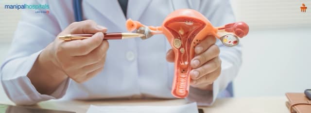 ovarian cancer stages