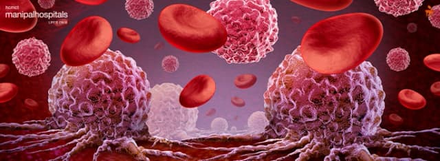 Blood Cancer Symptoms