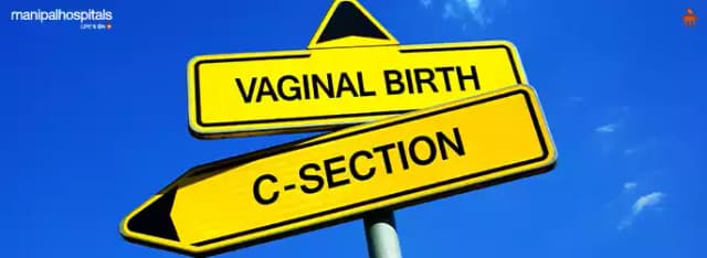 Demystifying C-Section Delivery: Why Doctors Recommend This Life-Saving Procedure