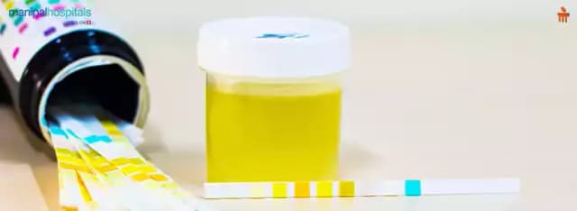 Protein in Urine: Causes, Symptoms & Treatment