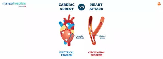 Heart Attack vs Cardiac Arrest: What to Do in the First 10 Minutes